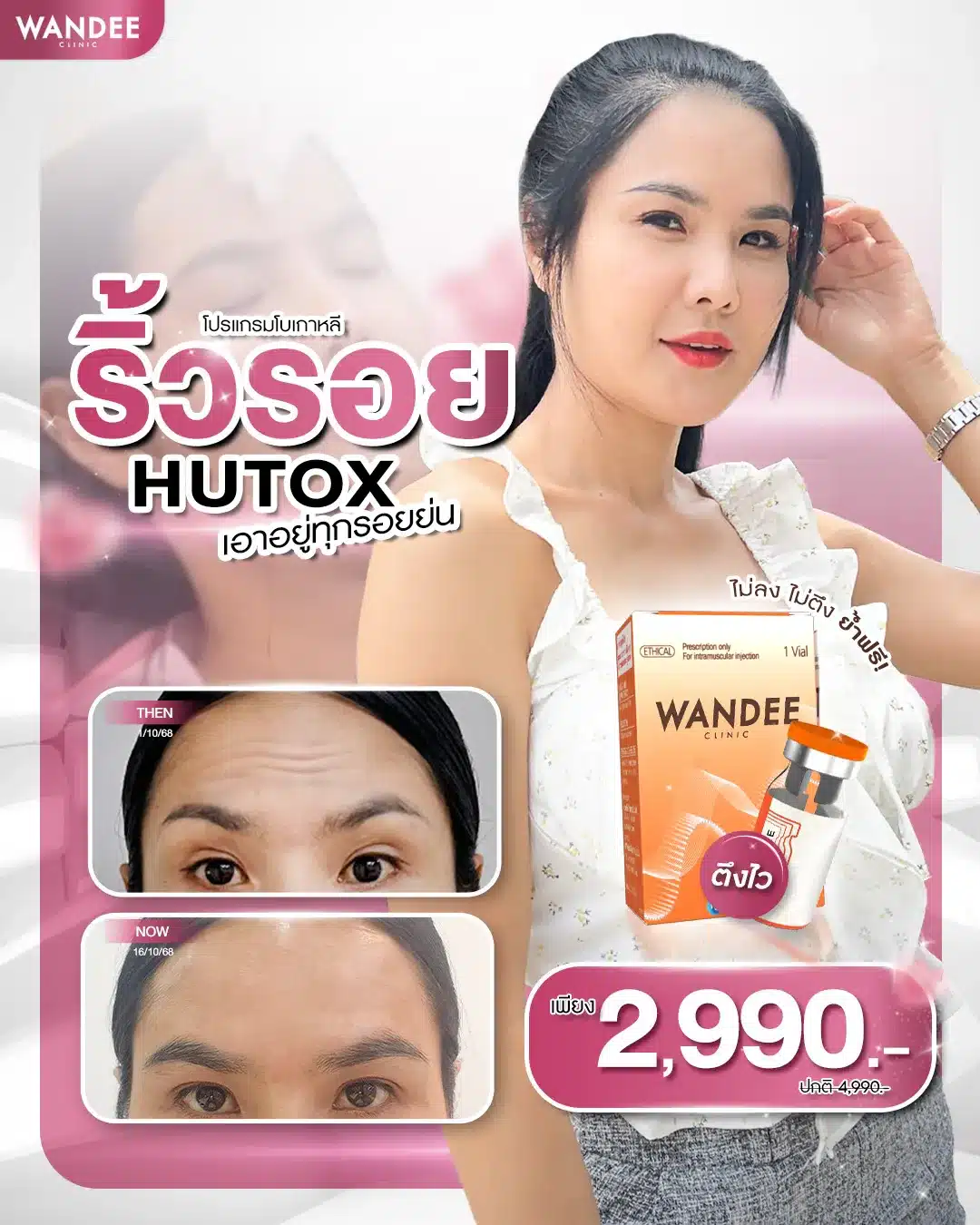 ราคาโบท็อกซ์ วันดี คลินิก