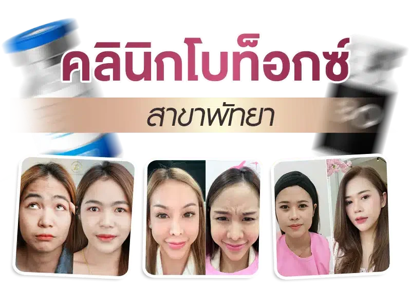 คลินิกโบท็อกซ์ พัทยา wandee clinic