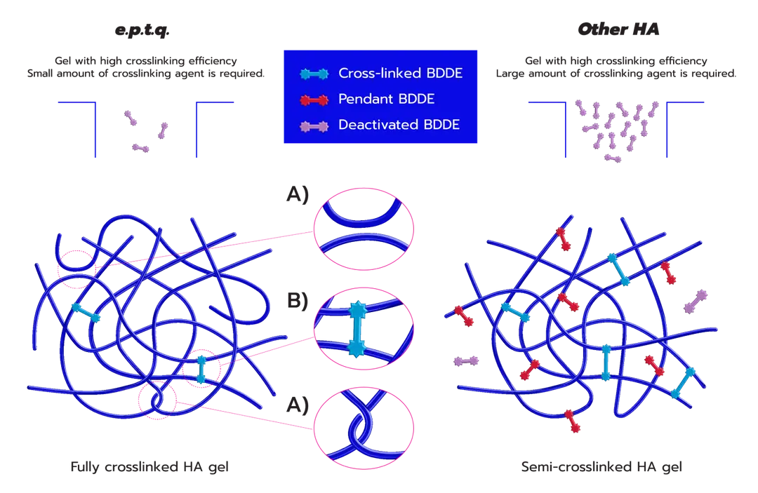 eptq Filler พัทยา ชลบุรี