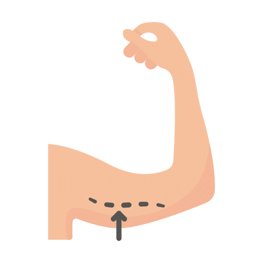 ฉีดเมโสแฟต บริเวณไหนได้บ้าง ต้นแขน