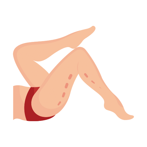 ฉีดเมโสแฟต บริเวณไหนได้บ้าง ต้นขา