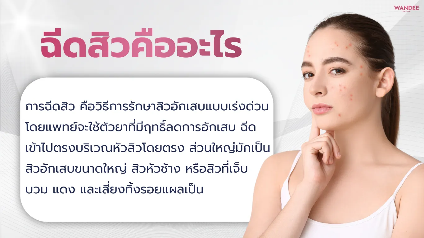ฉีดสิว พัทยา ทางลัดสุดฮิตที่คนเป็นสิวต้องรู้