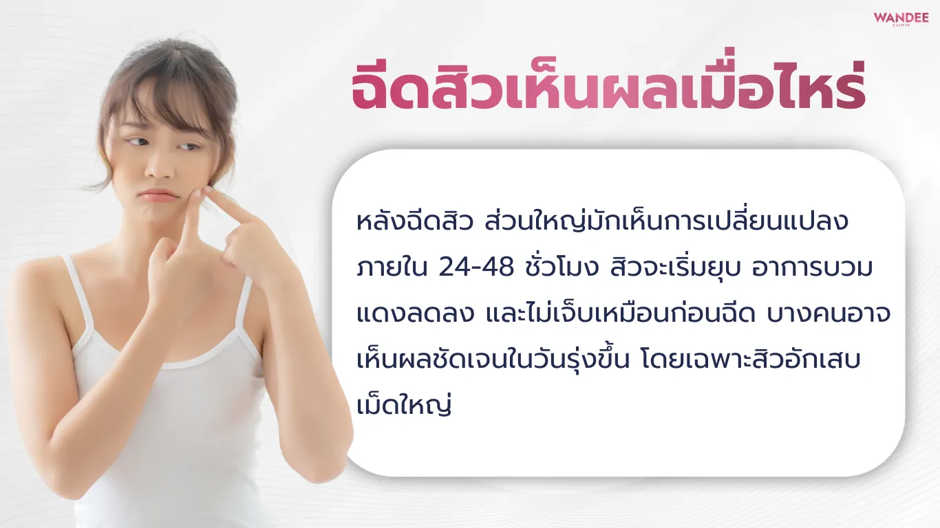 ฉีดสิว พัทยา ทางลัดสุดฮิตที่คนเป็นสิวต้องรู้