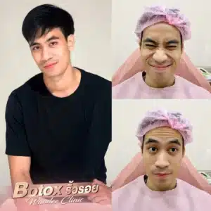 รีวิว Botox Wandee Clinic