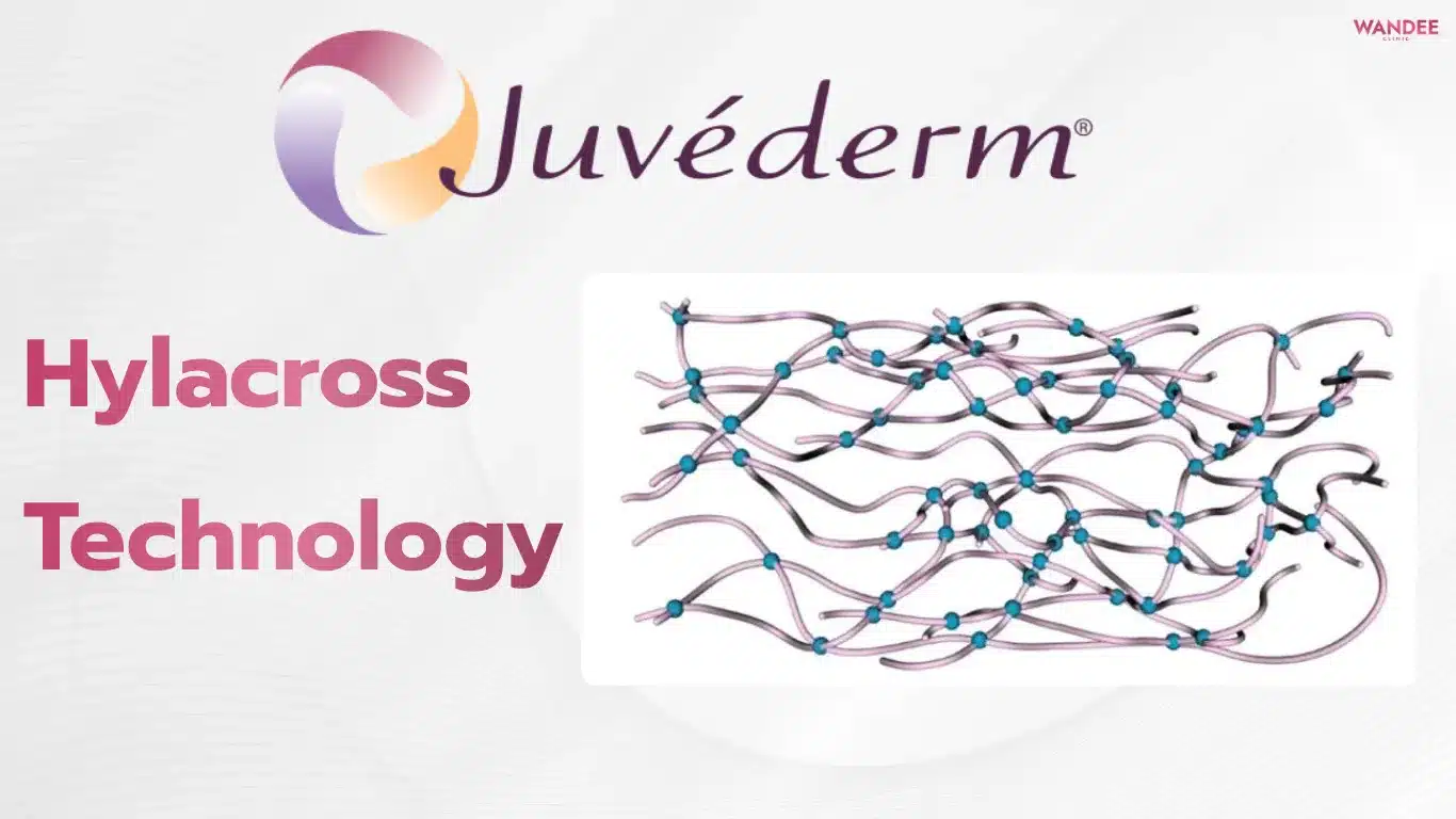เทคโนโลยี Hylacross ฟิลเลอร์ Juvederm