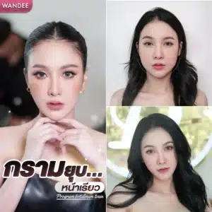 รีวิว Botox Wandee Clinic