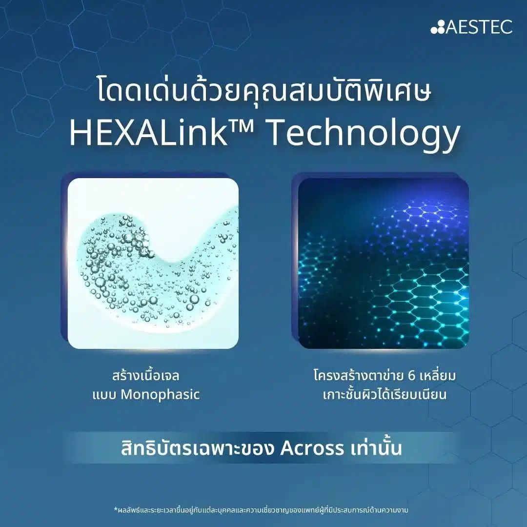 ฟิลเลอร์ Revolax ดีไหม? จุดเด่นที่ควรรู้