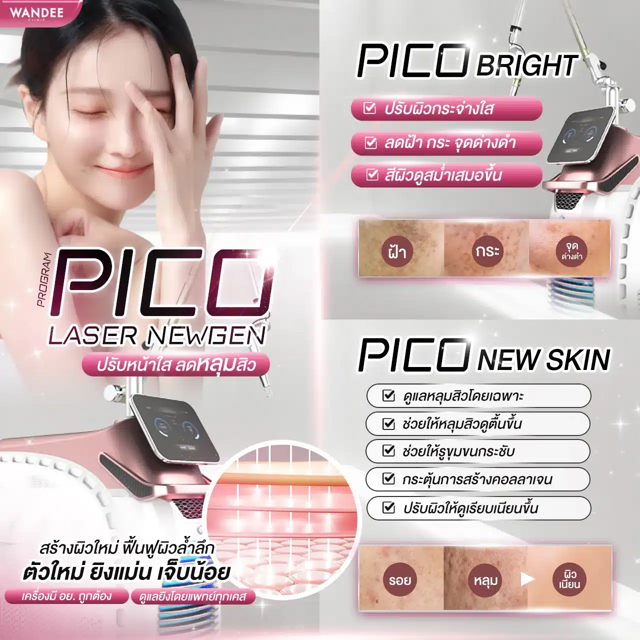 หลักการทำงานของ Pico Laser ทำไมจึงช่วยลดฝ้า กระ และรอยสิวได้ดี
