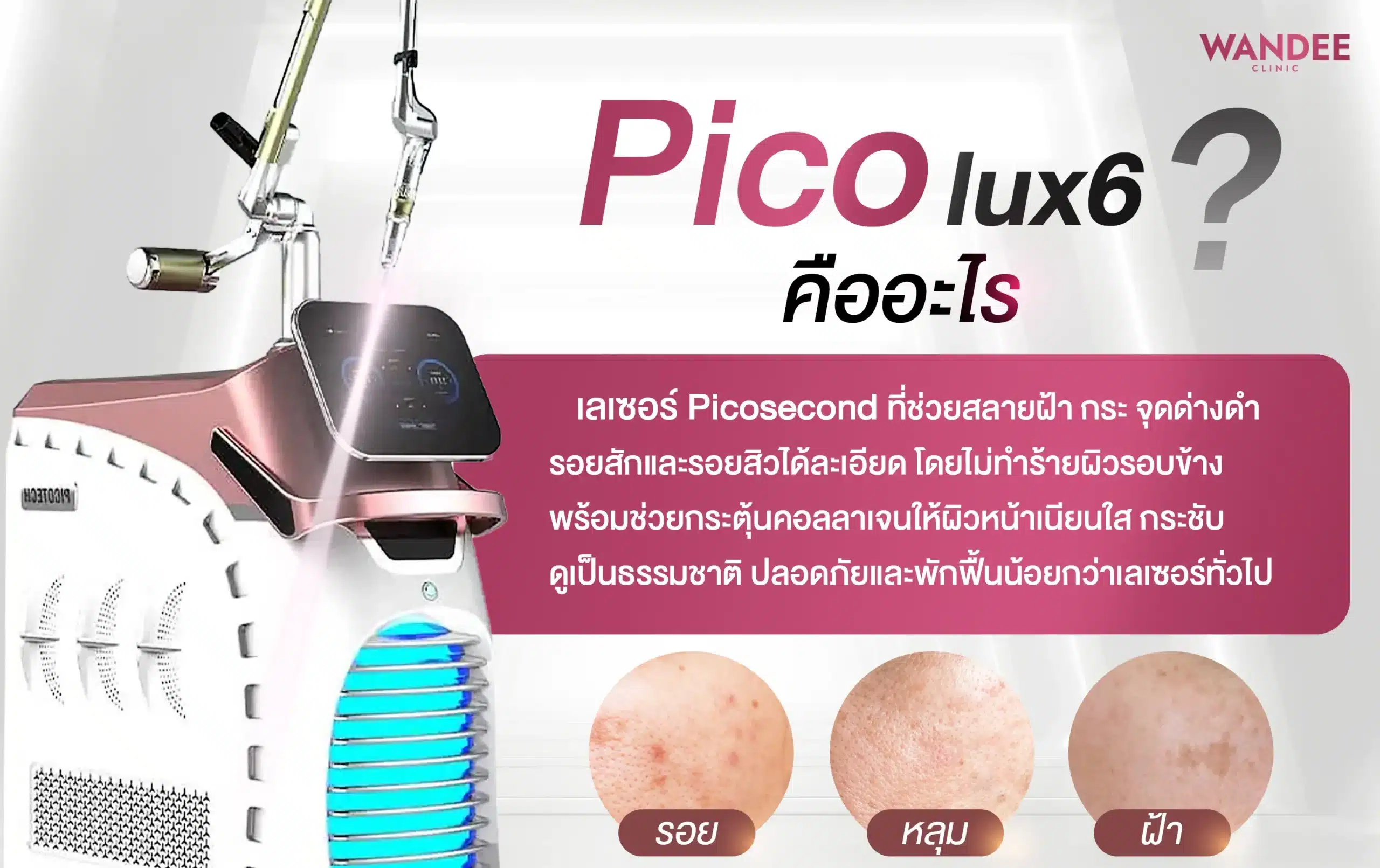 Pico คืออะไร